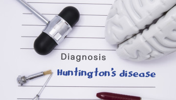 Huntington’s chorea: etiology of development, clinical picture