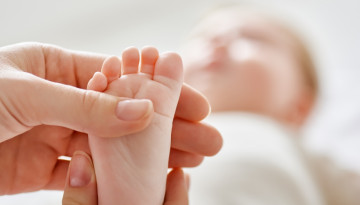 Лечение косолапости у новорожденных. Различные методы