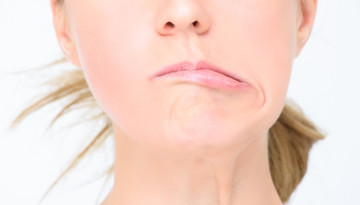 Causes, symptoms and treatment of facial nerve inflammation. Recovery