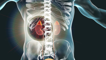 Causes, symptoms of pheochromocytoma. Treatment and possible complications