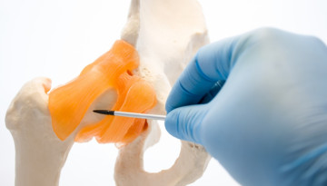 Ознаки та лікування перелому шийки стегна в похилому віці
