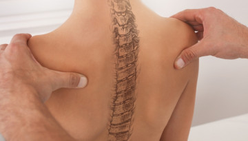 Kyphosis, lordosis and scoliosis - curvature of the spine, differentiation and treatment