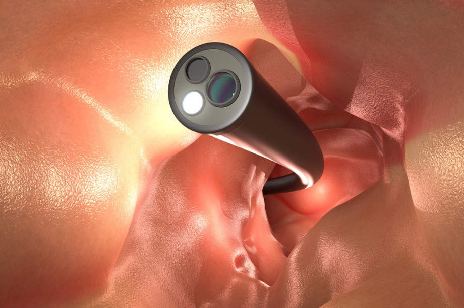 What is rectoscopy, features of its implementation, possible complications