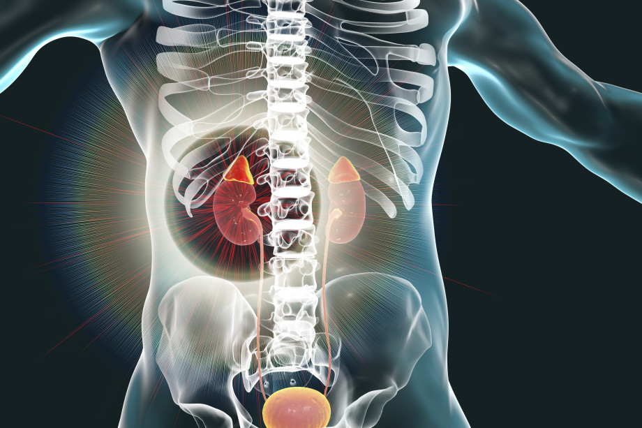 Causes, symptoms of pheochromocytoma. Treatment and possible complications