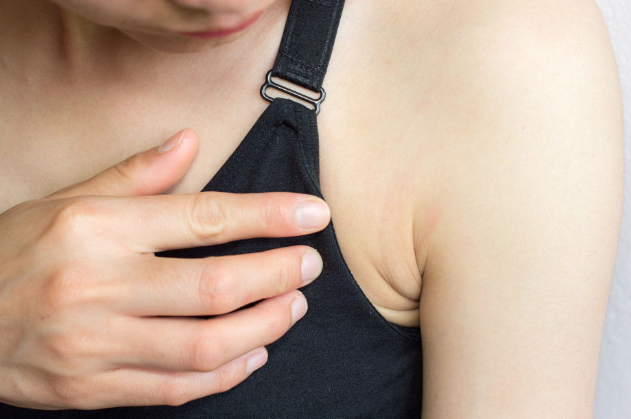 Hidradenitis under the armpit and other localizations. Causes, symptoms, treatment