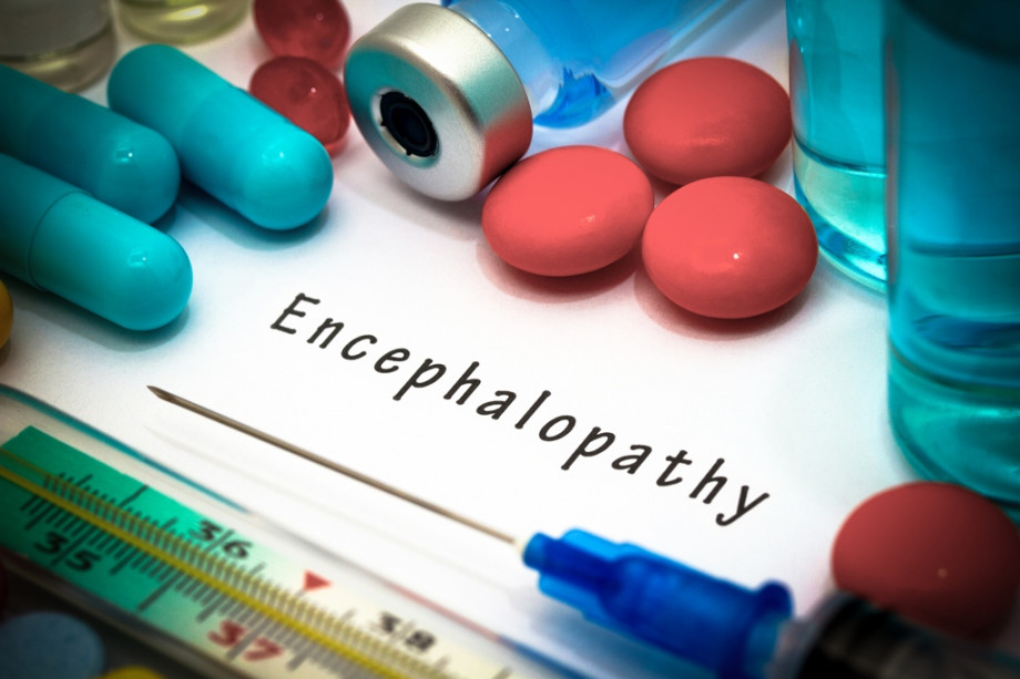 Основи лікування дисциркуляторної енцефалопатії 2 ступеня змішаного генезу