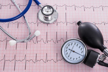 Arrhythmia - types, symptoms and general therapeutic principles