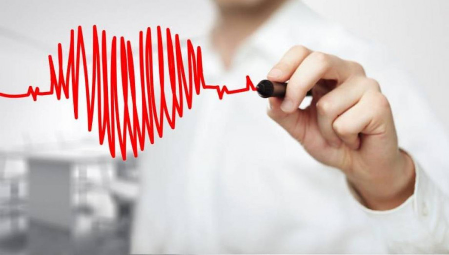 Діагностика порушень серцевого ритму шляхом моніторингу ЕКГ
