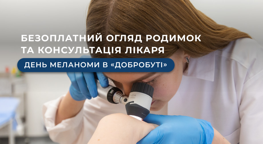 Free examination of moles and a doctor's consultation: Melanoma Day in Dobrobut