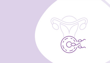 IVF program with stimulation and cryopreservation of embryos