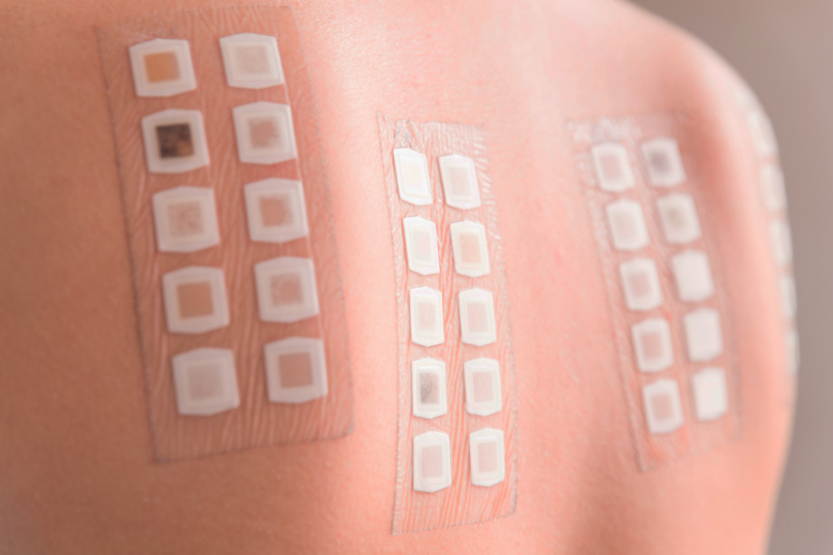 PATCH test complex (dermatology, children), without PATCH system cost