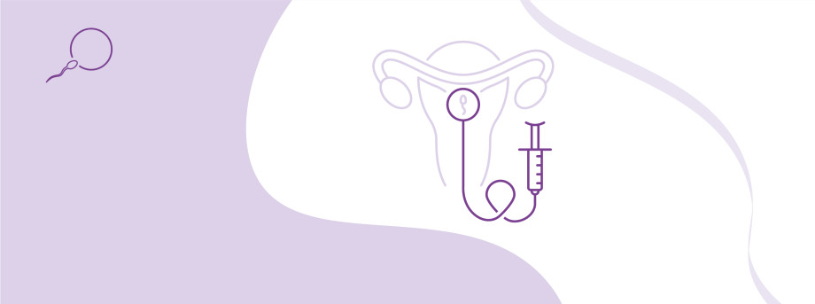 Intrauterine insemination program