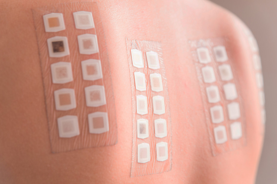 PATCH test complex (dermatology, children), without PATCH system cost