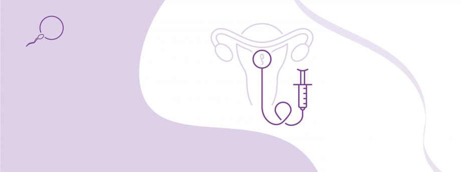 Програма ЕКЗ із стимуляцією та переносом ембріонів (без вартості медикаментів) - дистанційна підготовка