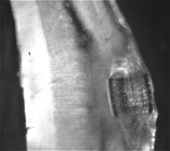 Scaffold for implantation in spinal cord injuries